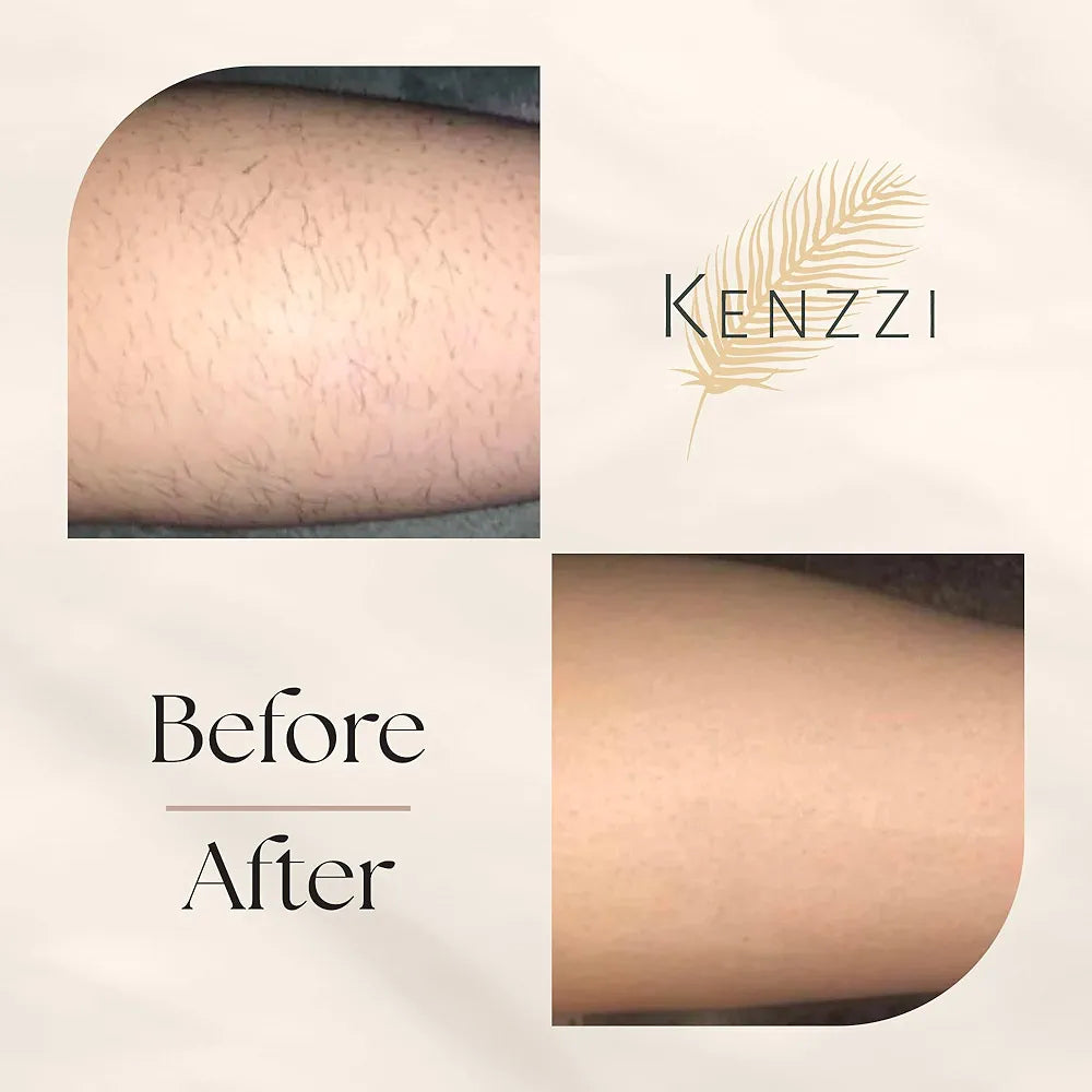 Kenzzi IPL Appareil d’épilation Laser "Authentique"