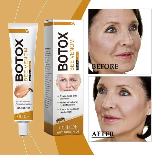 Botox cream
