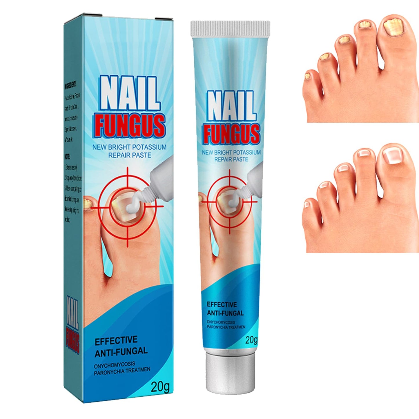 Nails fungus